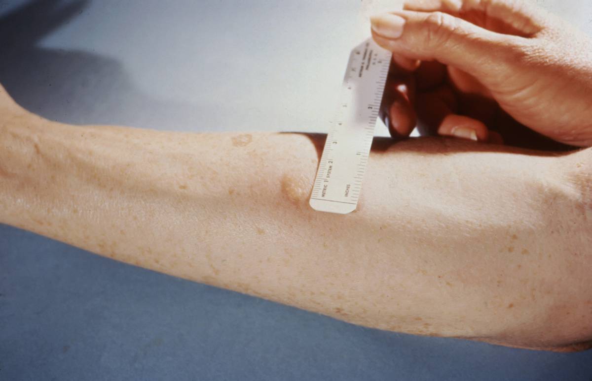 Athlete undergoing Muscle Risk Assessments with HRV monitor and grip strength test